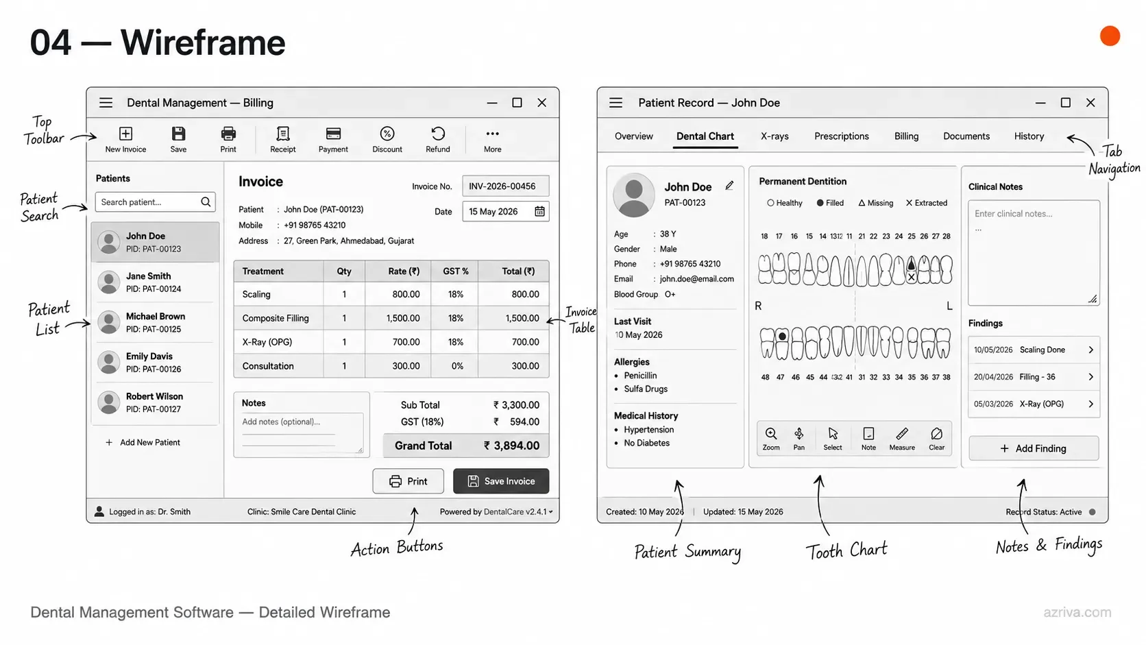 Detailed wireframe of dental billing software and EMR patient record desktop screens